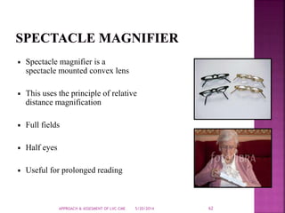 5/20/2014APPROACH & ASSESMENT OF LVC-CME 62
Spectacle magnifier is a
spectacle mounted convex lens
This uses the principle of relative
distance magnification
Full fields
Half eyes
Useful for prolonged reading
 