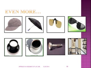 5/20/2014APPROACH & ASSESMENT OF LVC-CME 80
 