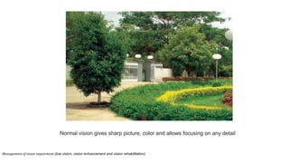 Normal vision gives sharp picture, color and allows focusing on any detail
Management of vision impairment (low vision, vision enhancement and vision rehabilitation)
 