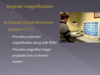  Closed circuit television
system-CCTV
› Provides projection
magnification along with RDM
› Provides magnified image
projected onto a monitor
screen.
 