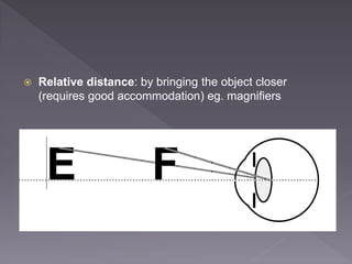  Relative distance: by bringing the object closer
(requires good accommodation) eg. magnifiers
 