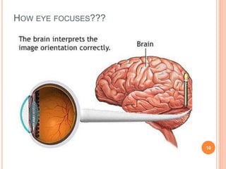 HOW EYE FOCUSES???
10
 