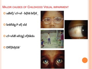  sdhf]/ cf+vf - b[li6 bf]if_
 le6fldg P sf] sld
 cf+vfdf nfUg] rf]6k6s
 Dff]ltljGb'
MAJOR CAUSES OF CHILDHOOD VISUAL IMPAIRMENT
 
