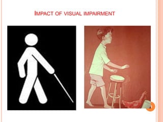 IMPACT OF VISUAL IMPAIRMENT
25
 