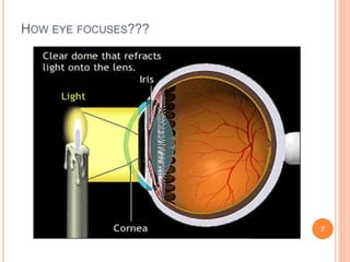 HOW EYE FOCUSES???
7
 