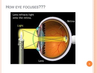 HOW EYE FOCUSES???
8
 