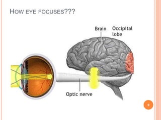 HOW EYE FOCUSES???
9
 
