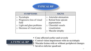 19
TYPICAL RP
A TYPICAL RP
SYMPTOMS SIGNS
o Nyctalopia
o Progressive loss of visual
field
o Light and glare problems
o Decrease of visual acuity
o Arteriolar attenuation
o Retinal bone spicule
pigmentation
o Choroidal vessels
visualization
o Macular atrophy
 Cone affected earlier and severely
 Central vision impairment with no nyctalopia
 Macular lesion with or without peripheral changes
 Involves inferior quadrant
 
