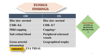 OD OS
Disc size- normal Disc size- normal
CDR- 0.6 CDR- 0.7
Mild cupping Cupping+
Sub retinal bleed Peripheral sclerosed
vessels
Gross arteriol
attenuation
Geographical trophy
4
ADVICE LVA TRIAL
DIAGNOSIS:
ATYPICAL
RETINITIS
PIGMENTOS
A
 