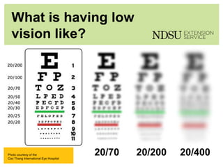 P: 555.123.4568 F: 555.123.4567
123 West Main Street, New York,
NY 10001
www.rightcare.com|
What is having low
vision like?
20/70 20/200 20/400Photo courtesy of the
Cao Thang International Eye Hospital
 