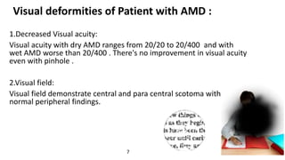 Low vision management of patient with AMD. | PPTX