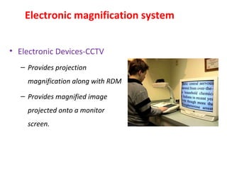 Electronic magnification system
• Electronic Devices-CCTV
– Provides projection
magnification along with RDM
– Provides magnified image
projected onto a monitor
screen.
 