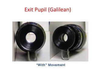 Exit Pupil (Galilean)
“With” Movement
 