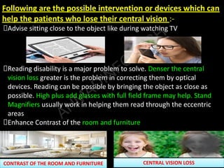 WHAT IS LOW VISION | LOW VISION INSTRUMENTS | LOW VISION SYMPTOMS ...