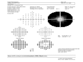 Low vision case Study Of Retintis Pigmentosa | PPTX
