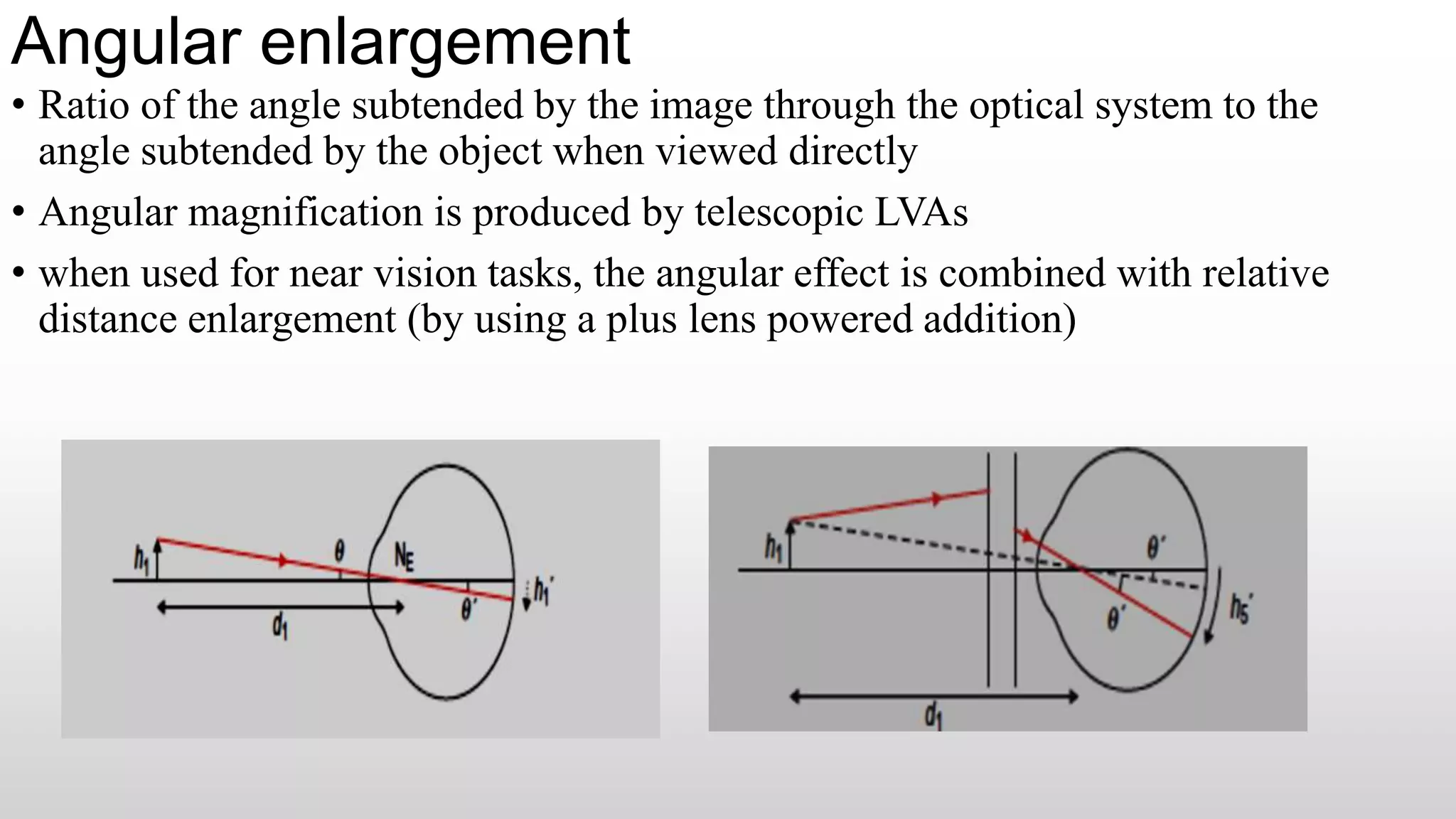 Angular enlargement
• Ratio of the angle subtended by the image through the optical system to the
angle subtended by the object when viewed directly
• Angular magnification is produced by telescopic LVAs
• when used for near vision tasks, the angular effect is combined with relative
distance enlargement (by using a plus lens powered addition)
 