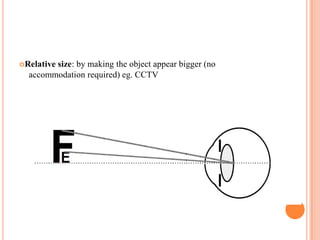 Relative size: by making the object appear bigger (no
accommodation required) eg. CCTV
 