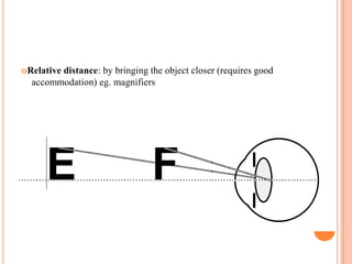 Relative distance: by bringing the object closer (requires good
accommodation) eg. magnifiers
 
