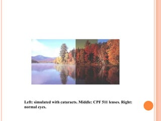 Left: simulated with cataracts. Middle: CPF 511 lenses. Right:
normal eyes.
 