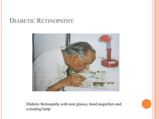 DIABETIC RETINOPATHY
Diabetic Retinopathy with near glasses, hand magnifiers and
a reading lamp
 