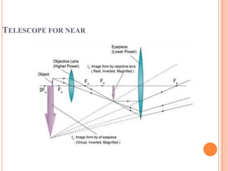 TELESCOPE FOR NEAR
 