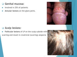  Genital mucosa:
 Involved in 25% of patients
 Annular lesions on the glans penis.
 Scalp lesions:
 Follicular lesions of LP on the scalp subside with
scarring and result in cicatricial (scarring) alopecia
 