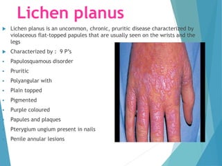 Lichen planus
 Lichen planus is an uncommon, chronic, pruritic disease characterized by
violaceous flat-topped papules that are usually seen on the wrists and the
legs
 Characterized by : 9 P’s
 Papulosquamous disorder
 Pruritic
 Polyangular with
 Plain topped
 Pigmented
 Purple coloured
 Papules and plaques
 Pterygium ungium present in nails
 Penile annular lesions
 