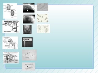Lp 16 urinary system & urinalysis 2008