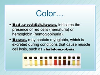 Color…
Red or reddish-brown- indicates the
presence of red cells (hematuria) or
hemoglobin (hemoglobinuria).
Brown- may contain myoglobin, which is
excreted during conditions that cause muscle
cell lysis, such as rhabdomyolysis.
 