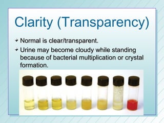 Clarity (Transparency)
Normal is clear/transparent.
Urine may become cloudy while standing
because of bacterial multiplication or crystal
formation.
 