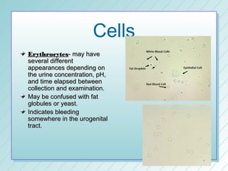 Cells
Erythrocytes- may have
several different
appearances depending on
the urine concentration, pH,
and time elapsed between
collection and examination.
May be confused with fat
globules or yeast.
Indicates bleeding
somewhere in the urogenital
tract.
 