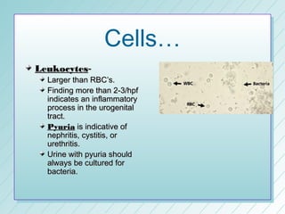 Cells…
Leukocytes-
  Larger than RBC’s.
  Finding more than 2-3/hpf
  indicates an inflammatory
  process in the urogenital
  tract.
  Pyuria is indicative of
  nephritis, cystitis, or
  urethritis.
  Urine with pyuria should
  always be cultured for
  bacteria.
 