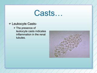 Casts…
Leukocyte Casts-
  The presence of
  leukocyte casts indicates
  inflammation in the renal
  tubules.
 