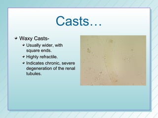 Casts…
Waxy Casts-
  Usually wider, with
  square ends.
  Highly refractile.
  Indicates chronic, severe
  degeneration of the renal
  tubules.
 