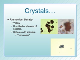 Crystals…
Ammonium biurate-
  Yellow
  Dumbbell or sheaves of
  needles.
  Spheres with spicules-
     “Thorn apples”
 