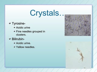 Crystals…
Tyrosine-
   Acidic urine
   Fine needles grouped in
   clusters.
Bilirubin-
   Acidic urine.
   Yellow needles.
 