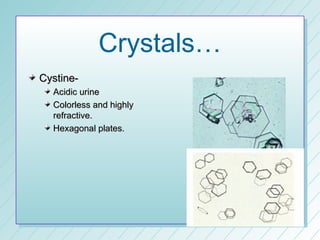 Crystals…
Cystine-
  Acidic urine
  Colorless and highly
  refractive.
  Hexagonal plates.
 