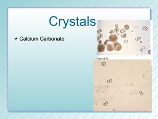 Crystals…
Calcium Carbonate
 
