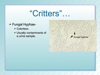 “Critters”…
Fungal Hyphae-
  Colorless.
  Usually contaminants of
  a urine sample.
 