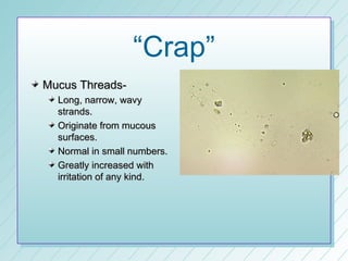 “Crap”
Mucus Threads-
  Long, narrow, wavy
  strands.
  Originate from mucous
  surfaces.
  Normal in small numbers.
  Greatly increased with
  irritation of any kind.
 