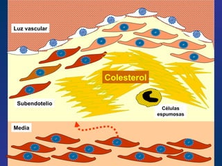 Subendotelio Luz vascular Media Células espumosas Colesterol 