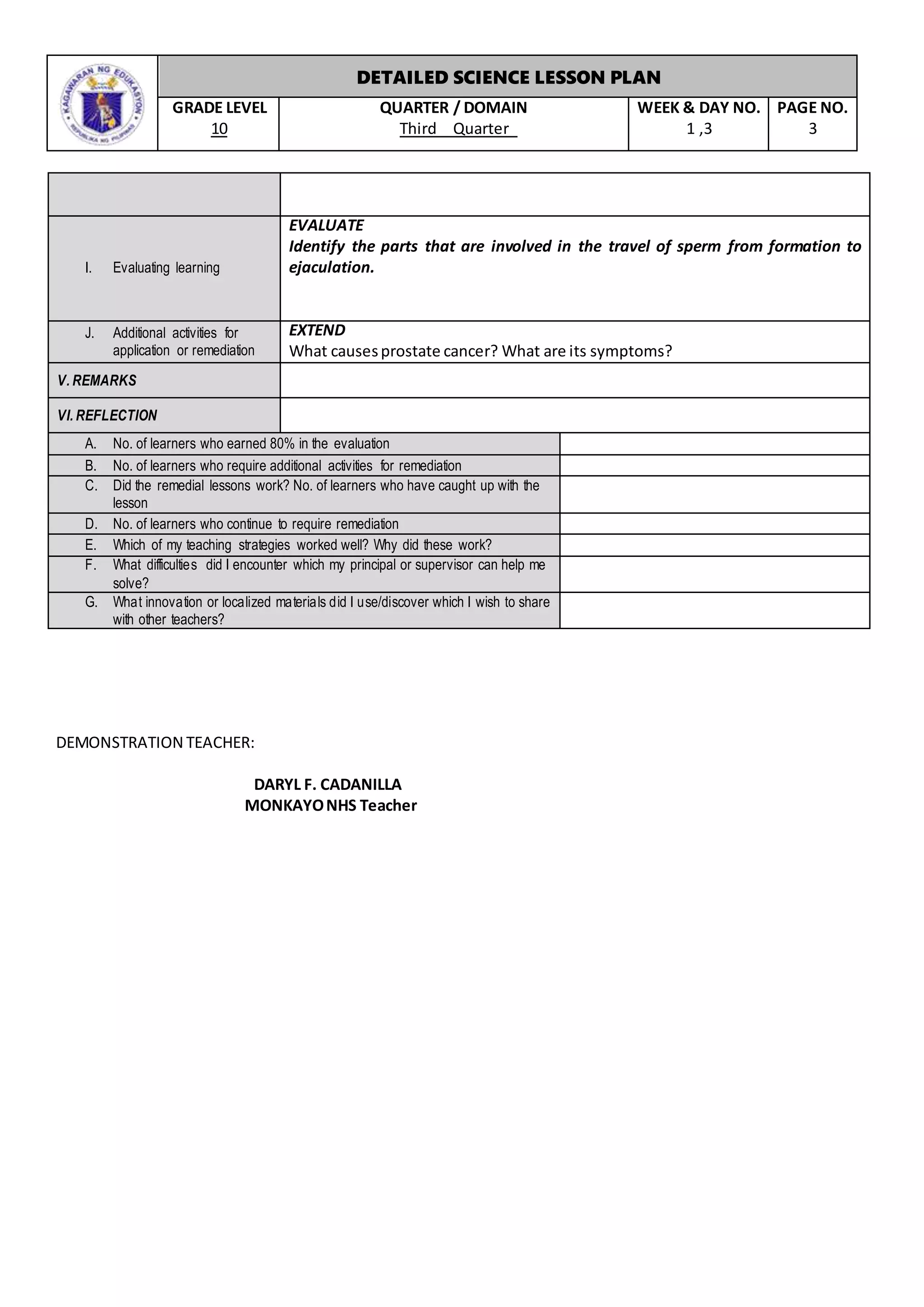 DETAILED SCIENCE LESSON PLAN
GRADE LEVEL
10
QUARTER / DOMAIN
Third Quarter
WEEK & DAY NO.
1 ,3
PAGE NO.
3
DEMONSTRATION TEACHER:
DARYL F. CADANILLA
MONKAYONHS Teacher
I. Evaluating learning
EVALUATE
Identify the parts that are involved in the travel of sperm from formation to
ejaculation.
J. Additional activities for
application or remediation
EXTEND
What causesprostate cancer? What are its symptoms?
V. REMARKS
VI. REFLECTION
A. No. of learners who earned 80% in the evaluation
B. No. of learners who require additional activities for remediation
C. Did the remedial lessons work? No. of learners who have caught up with the
lesson
D. No. of learners who continue to require remediation
E. Which of my teaching strategies worked well? Why did these work?
F. What difficulties did I encounter which my principal or supervisor can help me
solve?
G. What innovation or localized materials did I use/discover which I wish to share
with other teachers?
 