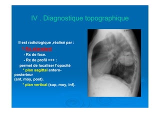 IV . Diagnostique topographiqueIV . Diagnostique topographique
Il est radiologique ,réalisé par :Il est radiologique ,réalisé par :
11..Rx standardRx standard
-- Rx de face.Rx de face.-- Rx de face.Rx de face.
-- Rx de profil +++ :Rx de profil +++ :
permet de localiser l’opacitépermet de localiser l’opacité
* plan sagittal* plan sagittal anteroantero--
posterieurposterieur
(ant, moy, post).(ant, moy, post).
* plan vertical* plan vertical (sup, moy, inf).(sup, moy, inf).
 