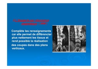 33..L’imagerie par résonanceL’imagerie par résonance
magnétiquemagnétique ( IRM )( IRM )
Complète les renseignementsComplète les renseignements
car elle permet de différenciercar elle permet de différenciercar elle permet de différenciercar elle permet de différencier
plus nettement les tissus etplus nettement les tissus et
rend possible la réalisationrend possible la réalisation
des coupes dans des plansdes coupes dans des plans
verticaux.verticaux.
 