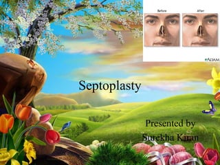 Septoplasty
Presented by
Surekha Kiran

 