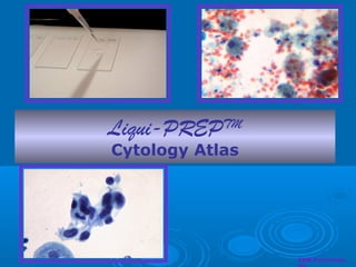 Liqui-PREPTM
Cytology Atlas
LGM International,
 