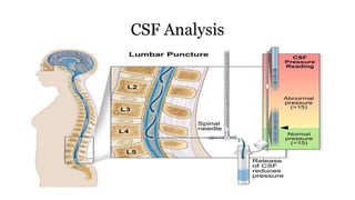 CSF Analysis
 