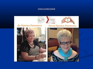 омоложенияомоложения
 