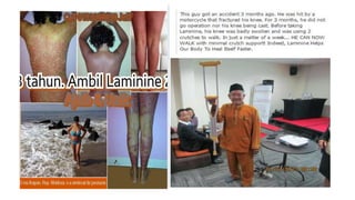 Laminine - l.p.g.n. Angela B.