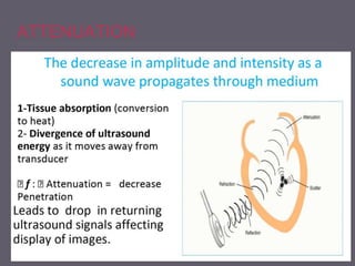ATTENUATION
 